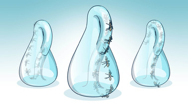 Drei Kleinsche-Flaschen mit gezeichneten Teilchen im Innern und der Frage Auswählen?